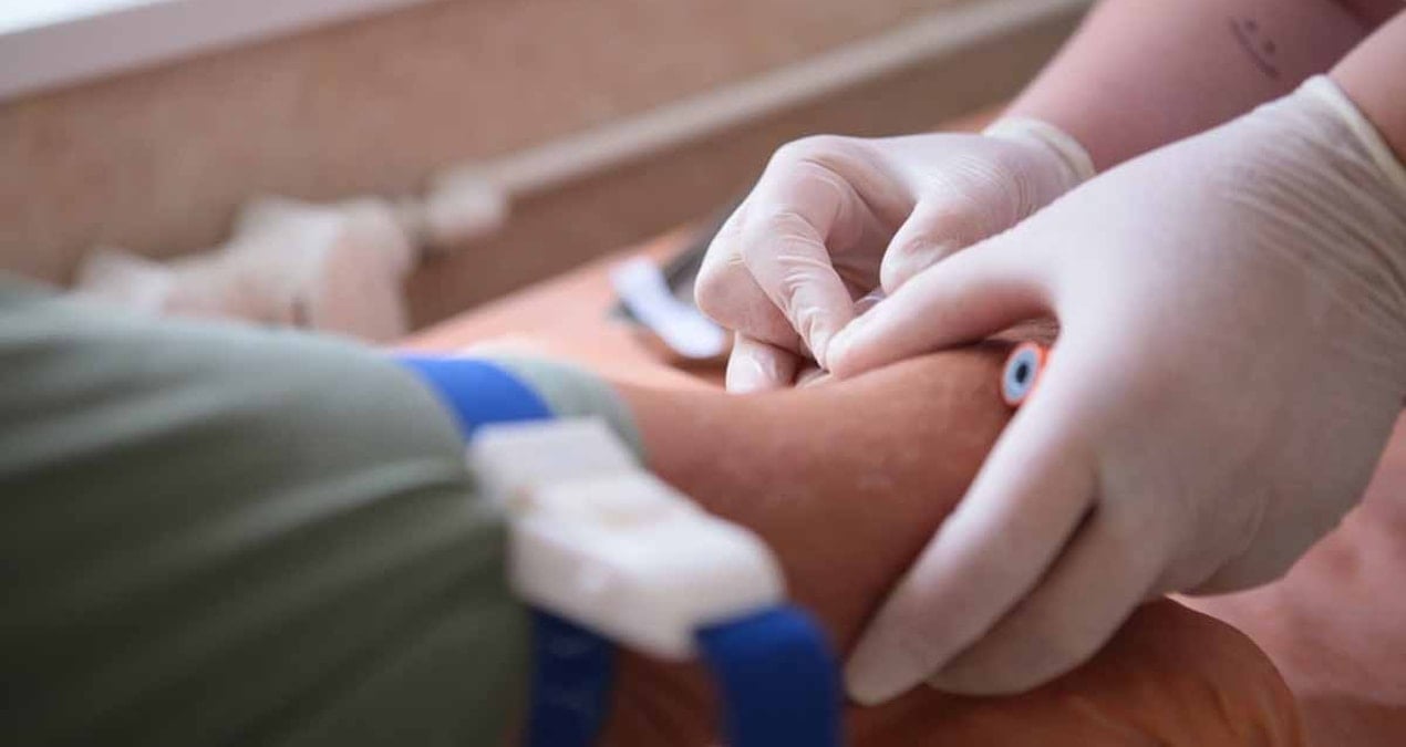 40 yasindan sonra herkesin yaptirmasi gereken 3 kan testi J5ps3Qdm.jpg